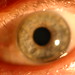 My Eye - February 23. 2011