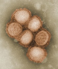 Virus de la gripe. Foto de Sanofi Pasteur en Flickr.