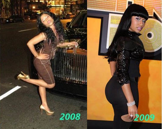 Nicki Minaj Booty Before and