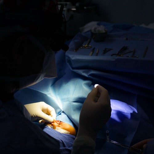 Cleft Palate surgery, Guatemala - Photographer Ashli Akins