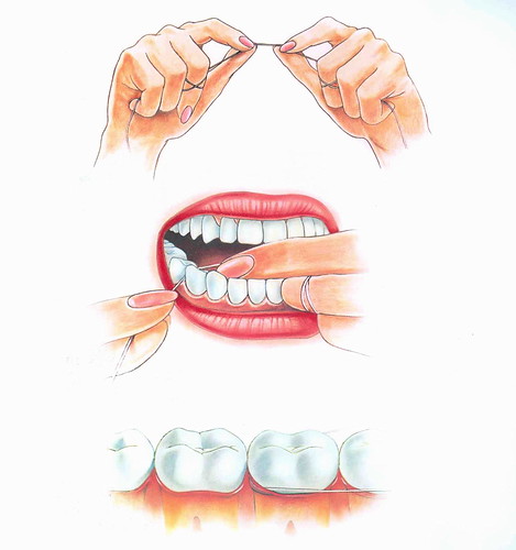 Dental Hygiene - flossing