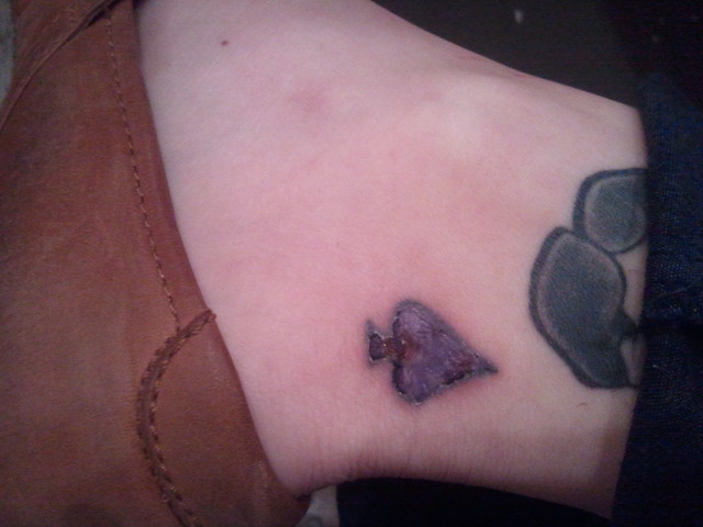 Day 3 Infected Tattoo Gross Tattoo I got jacked up in Texas