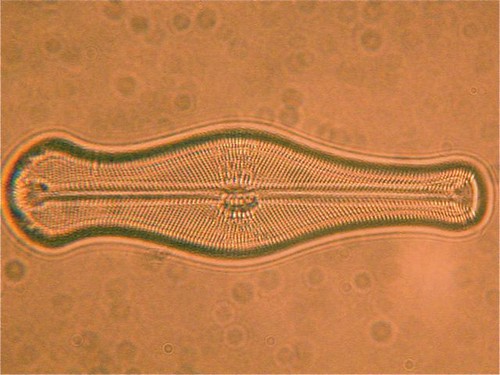 Pest diatom