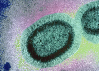 Photo:Influenza virus By:Sanofi Pasteur