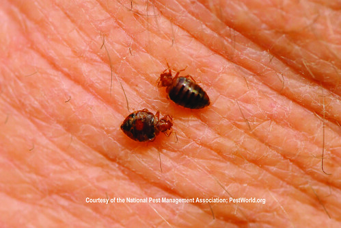 Things That Go Chomp in the Night: Bedbugs, scabies and fleas