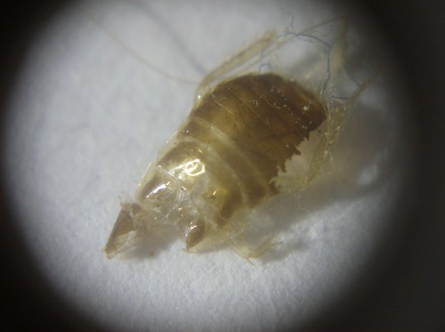 ... probable cockroach nymph shed skin] Â« Got Bed Bugs? Bedbugger Forums