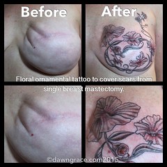 Floral ornamental design to cover scars from single breast mastectomy. Honored to be part of the healing. 💖thanks for looking! tattoo #tattoos #tattooing #womenink #chicagotattooshops #ladytattooer #feminine #tcm #tam #tattoooftheday #totd