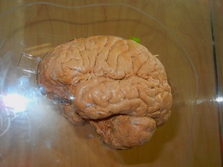 preserved human brain