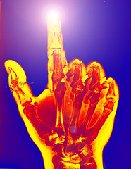 Batch: X-Ray Hand