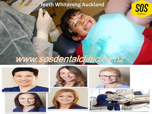 Auckland Teeth Whitening