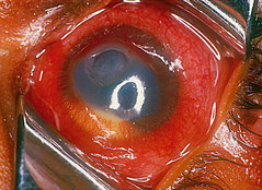 Infektion av hornhinnan. Uppstår ofta efter en liten erosion i epitelet där bakterier kan ta sig in. Orsakas i regel av s. aureus, epidermis, mm. 
Subakut insjuknande med ljuskänslighet, ont, rött och ibland kladdande öga.