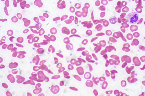 Abc - Intro To Haematology Flashcards 