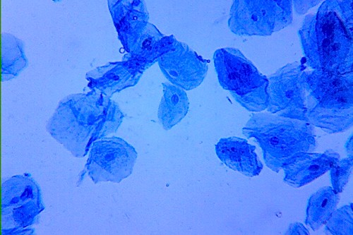 cheek cells under microscope labeled