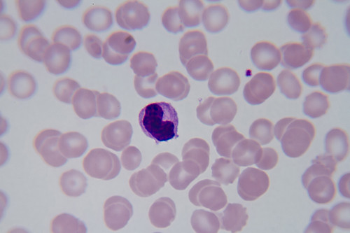 Plasmodium malaria
