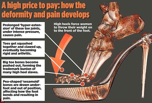 high-heels-foot-pain