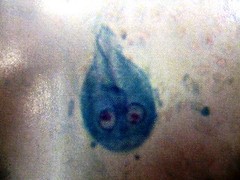 giardiasis, water born diarrhea, cell shaped like light bulb w 2 nuclei


4 pairs of flagella