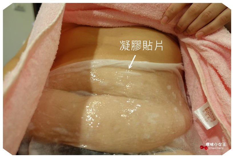 美診所 低溫減脂 MICOOL Coolsculpturing 韓國減脂 體雕 抽脂 無傷口減脂 減重