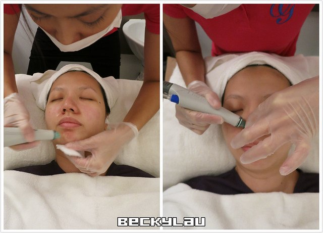 GLAMOUR X Shining facial ll 療程 - 7