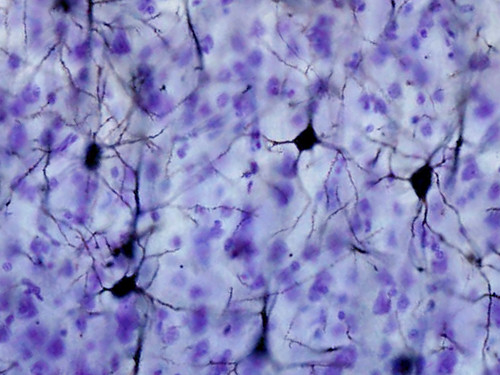 Golgi stained neuron