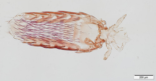 Elongate, prickly louse, about 1.2 mm long, with relatively short thorax, short legs, and small grabby parts