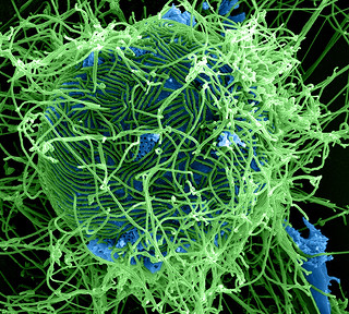 Photo:Ebola Virus Particles By:NIAID