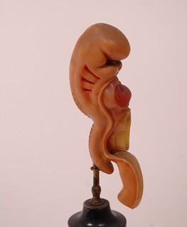 Approx. 3mm Embryo