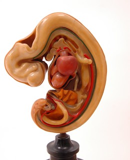10mm Embryo Dissected