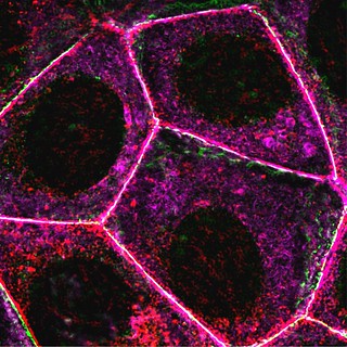 Connecting the dots for cell adhesion