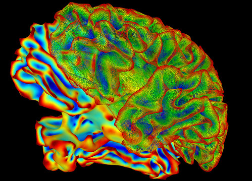 SumaLateral Whole Brain Image