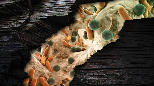 Microbes in a Fracking Well