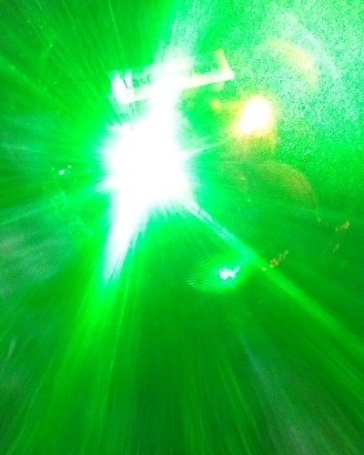 lights laser