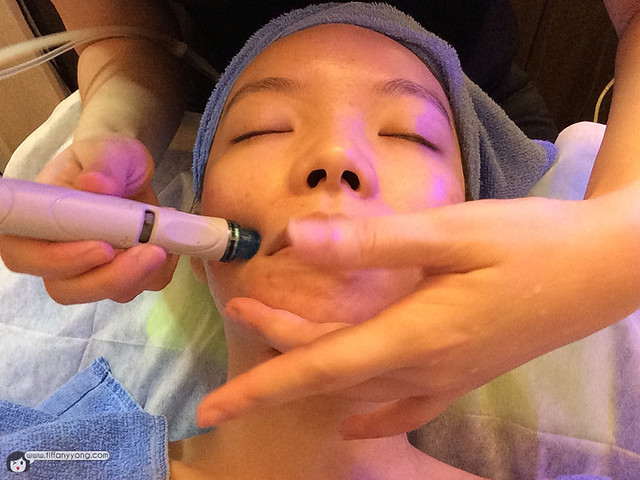 Hydrafacial Treatment Tiffany Yong