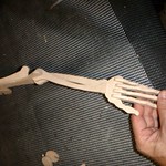 skelett2